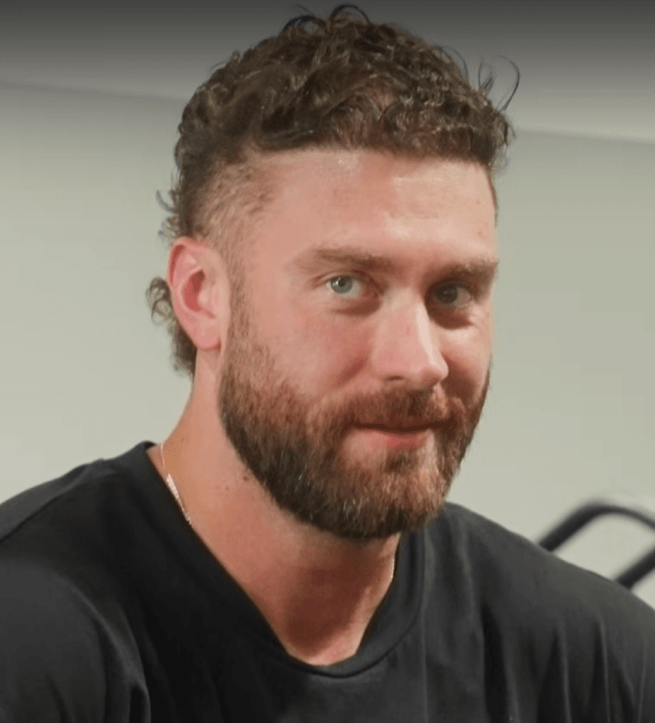 Chris Bumstead Cbum Hair Transplant: The Full, Confirmed Story