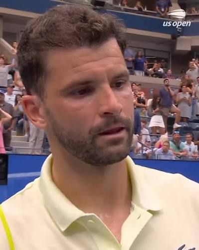 Grigor Dimitrov Hair Transplant: The Ultimate Style Ace of the Tennis Star