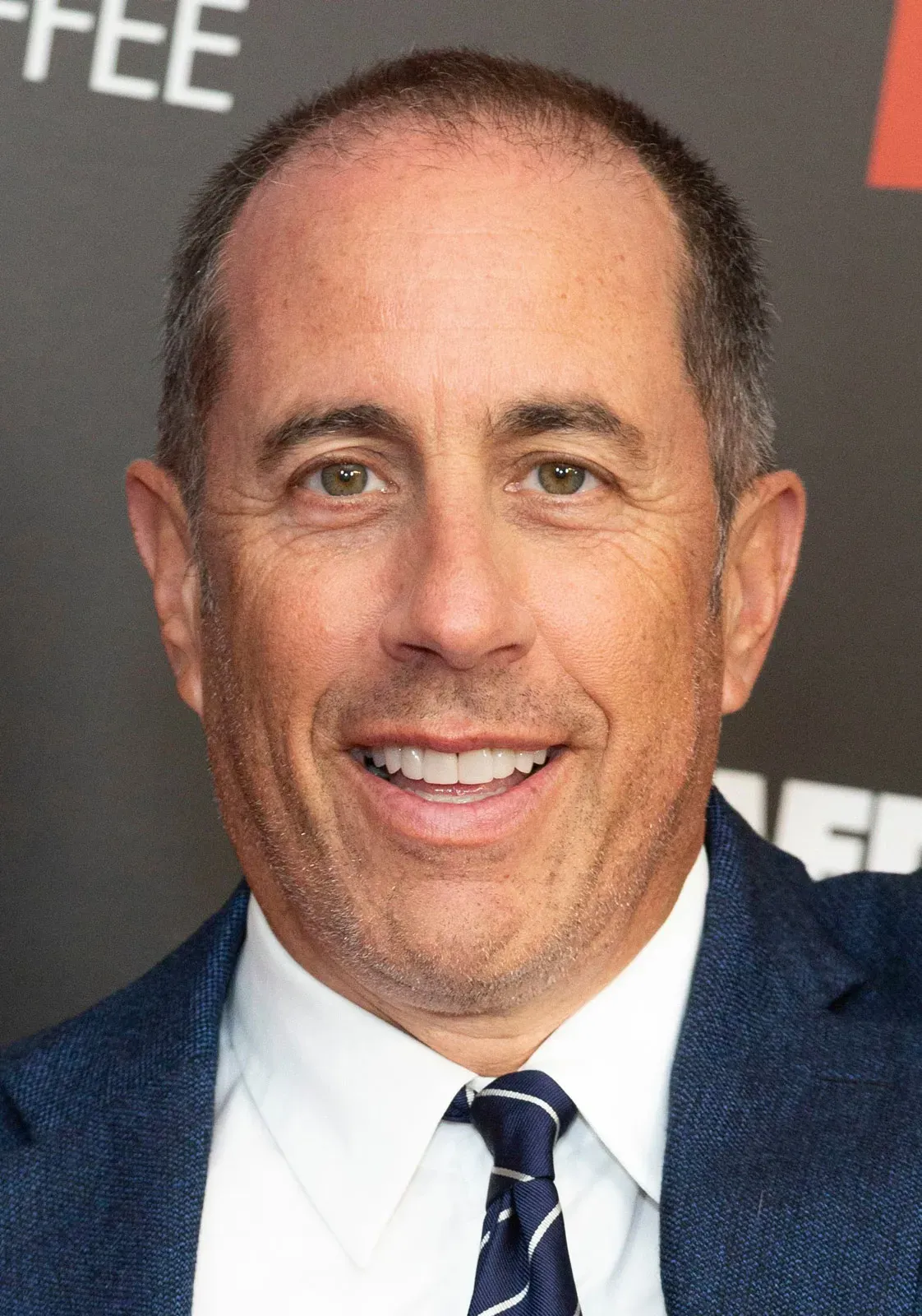 Jerry Seinfeld Hair Transplant