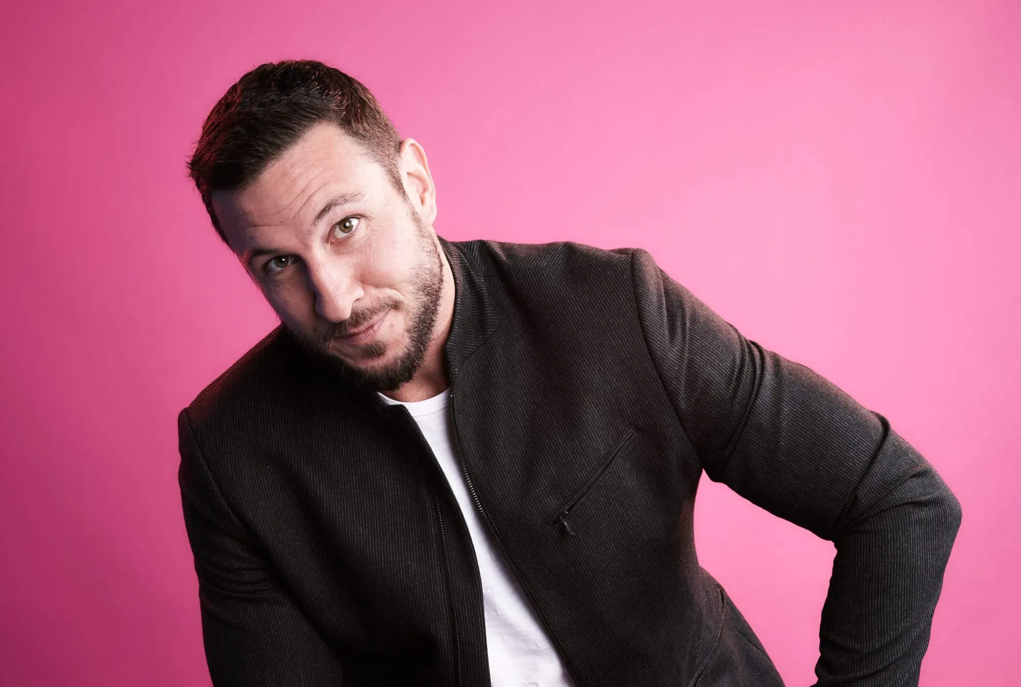 Pablo Schreiber Hair Transplant