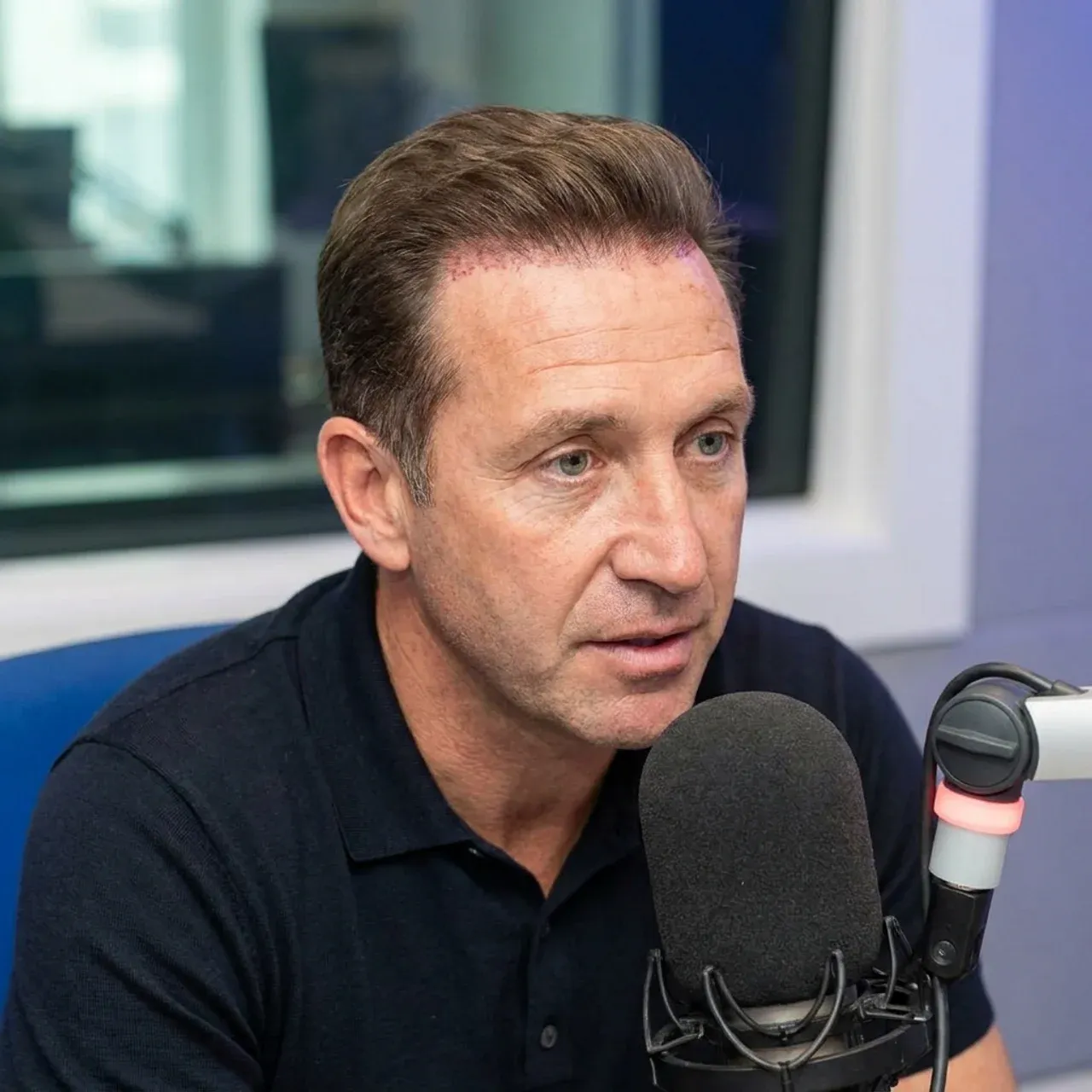 Jason Cundy Hair Transplant: The Ultimate Restoration Playbook