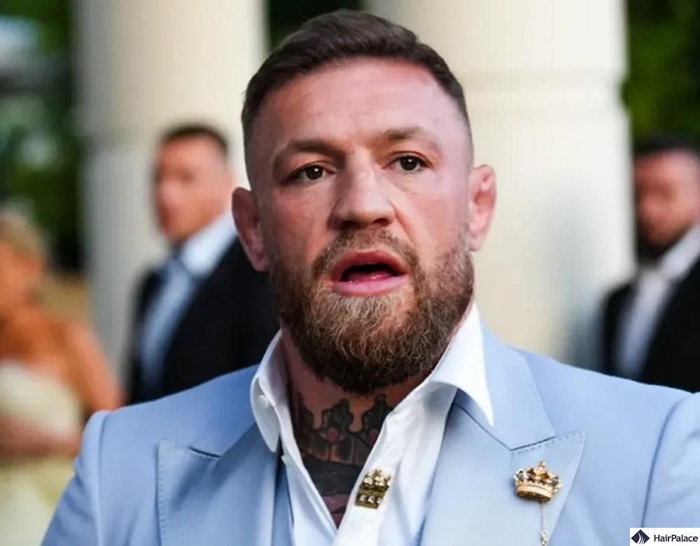 Conor McGregor Hair Transplant: The Complete Timeline, Evidence, and the "Failed" Theory